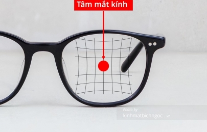 Mắt dại là gì? Nguyên nhân và cách chữa?